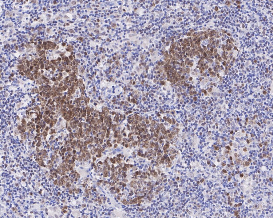 Immunohistochemical analysis of paraffin-embedded human tonsil tissue using anti-BOB1 antibody. The section was pre-treated using heat mediated antigen retrieval with sodium citrate buffer (pH 6.0) for 2 minutes. The tissues were blocked in 5% BSA for 30 minutes at room temperature, washed with ddH2O and PBS, and then probed with the primary antibody (ET7109-68, 1/200)  for 30 minutes at room temperature. The detection was performed using an HRP conjugated compact polymer system. DAB was used as the chromogen. Tissues were counterstained with hematoxylin and mounted with DPX.