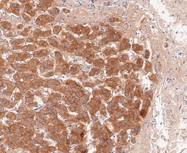 Immunohistochemical analysis of paraffin-embedded human liver tissue using anti-SAA4 antibody. The section was pre-treated using heat mediated antigen retrieval with Tris-EDTA buffer (pH 9.0) for 20 minutes.The tissues were blocked in 5% BSA for 30 minutes at room temperature, washed with ddH2O and PBS, and then probed with the primary antibody (ET7109-69, 1/50) for 30 minutes at room temperature. The detection was performed using an HRP conjugated compact polymer system. DAB was used as the chromogen. Tissues were counterstained with hematoxylin and mounted with DPX.