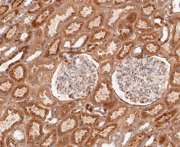 Immunohistochemical analysis of paraffin-embedded human kidney tissue using anti-SAA4 antibody. The section was pre-treated using heat mediated antigen retrieval with Tris-EDTA buffer (pH 9.0) for 20 minutes.The tissues were blocked in 5% BSA for 30 minutes at room temperature, washed with ddH2O and PBS, and then probed with the primary antibody (ET7109-69, 1/50) for 30 minutes at room temperature. The detection was performed using an HRP conjugated compact polymer system. DAB was used as the chromogen. Tissues were counterstained with hematoxylin and mounted with DPX.