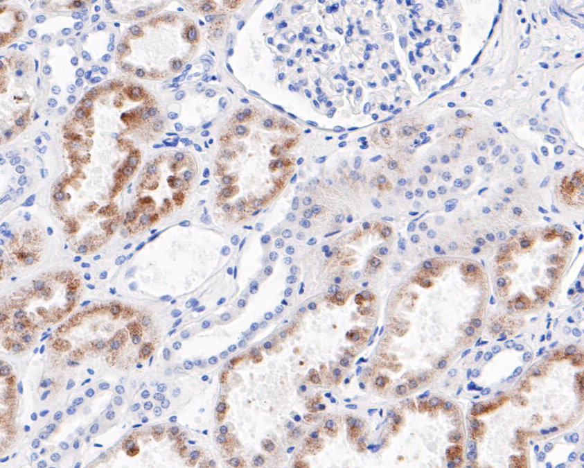Immunohistochemical analysis of paraffin-embedded human kidney tissue using anti-ENTPD5 antibody. The section was pre-treated using heat mediated antigen retrieval with Tris-EDTA buffer (pH 8.0-8.4) for 20 minutes.The tissues were blocked in 5% BSA for 30 minutes at room temperature, washed with ddH2O and PBS, and then probed with the primary antibody (ET7109-70, 1/100) for 30 minutes at room temperature. The detection was performed using an HRP conjugated compact polymer system. DAB was used as the chromogen. Tissues were counterstained with hematoxylin and mounted with DPX.