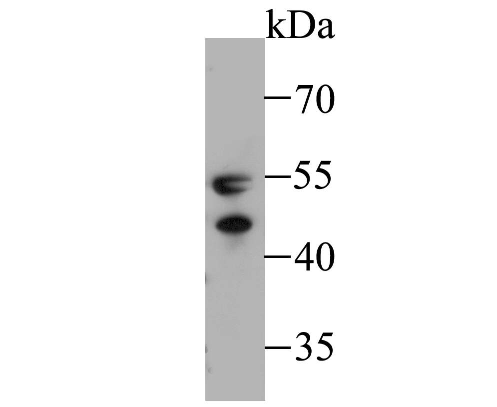 Western blot analysis of Tryptophanyl tRNA synthetase / WRS on K562 cell lysate. Proteins were transferred to a PVDF membrane and blocked with 5% BSA in PBS for 1 hour at room temperature. The primary antibody (ET7109-73, 1/500) was used in 5% BSA at room temperature for 2 hours. Goat Anti-Rabbit IgG - HRP Secondary Antibody (HA1001) at 1:5,000 dilution was used for 1 hour at room temperature.