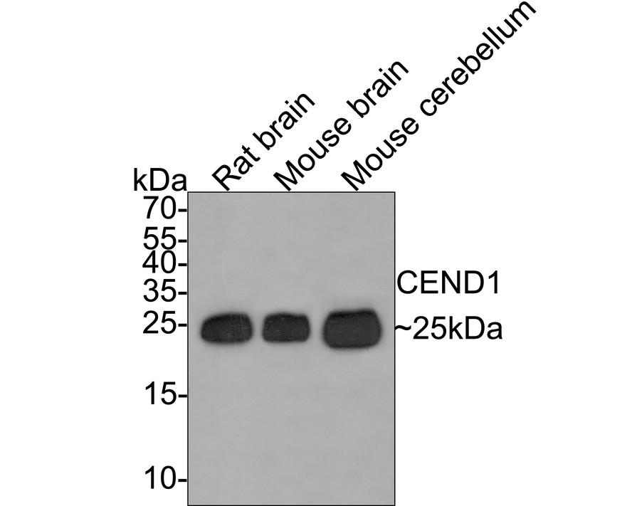 Western blot analysis of CEND1 on different lysates with Rabbit anti-CEND1 antibody (ET7109-75) at 1/5,000 dilution.<br />
<br />
Lane 1: Rat brain tissue lysate<br />
Lane 2: Mouse brain tissue lysate<br />
Lane 3: Mouse cerebellum tissue lysate<br />
<br />
Lysates/proteins at 20 µg/Lane.<br />
<br />
Predicted band size: 15 kDa<br />
Observed band size: 25 kDa<br />
<br />
Exposure time: 2 minutes;<br />
<br />
15% SDS-PAGE gel.<br />
<br />
Proteins were transferred to a PVDF membrane and blocked with 5% NFDM/TBST for 1 hour at room temperature. The primary antibody (ET7109-75) at 1/5,000 dilution was used in 5% NFDM/TBST at room temperature for 2 hours. Goat Anti-Rabbit IgG - HRP Secondary Antibody (HA1001) at 1:300,000 dilution was used for 1 hour at room temperature.