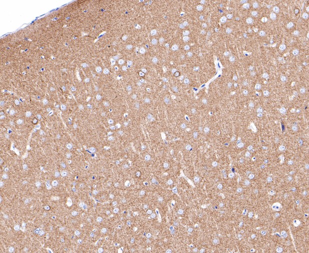 Immunohistochemical analysis of paraffin-embedded rat brain tissue using anti-CEND1 antibody. The section was pre-treated using heat mediated antigen retrieval with Tris-EDTA buffer (pH 8.0-8.4) for 20 minutes.The tissues were blocked in 5% BSA for 30 minutes at room temperature, washed with ddH2O and PBS, and then probed with the primary antibody (ET7109-75, 1/200) for 30 minutes at room temperature. The detection was performed using an HRP conjugated compact polymer system. DAB was used as the chromogen. Tissues were counterstained with hematoxylin and mounted with DPX.