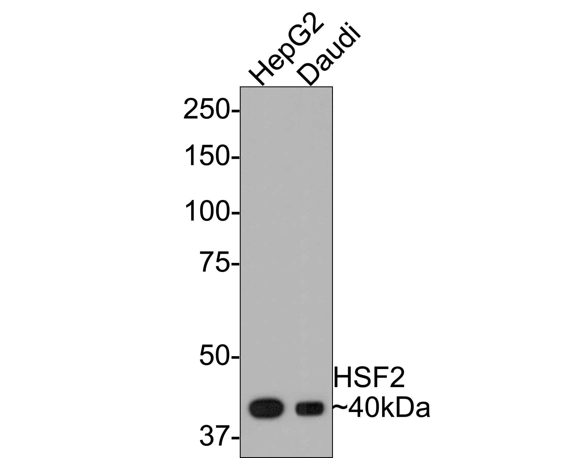 Western blot analysis of HSF2 on different lysates with Rabbit anti-HSF2 antibody (ET7109-78) at 1/500 dilution.<br />
<br />
Lane 1: HepG2 cell lysate<br />
Lane 2: Daudi cell lysate<br />
<br />
Lysates/proteins at 10 µg/Lane.<br />
<br />
Predicted band size: 60 kDa<br />
Observed band size: 40 kDa<br />
<br />
Exposure time: 2 minutes;<br />
<br />
8% SDS-PAGE gel.<br />
<br />
Proteins were transferred to a PVDF membrane and blocked with 5% NFDM/TBST for 1 hour at room temperature. The primary antibody (ET7109-78) at 1/500 dilution was used in 5% NFDM/TBST at room temperature for 2 hours. Goat Anti-Rabbit IgG - HRP Secondary Antibody (HA1001) at 1:300,000 dilution was used for 1 hour at room temperature.