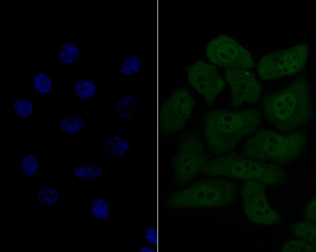 ICC staining of HSF2 in HepG2 cells (green). Formalin fixed cells were permeabilized with 0.1% Triton X-100 in TBS for 10 minutes at room temperature and blocked with 1% Blocker BSA for 15 minutes at room temperature. Cells were probed with the primary antibody (ET7109-78, 1/50) for 1 hour at room temperature, washed with PBS. Alexa Fluor®488 Goat anti-Rabbit IgG was used as the secondary antibody at 1/100 dilution. The nuclear counter stain is DAPI (blue).