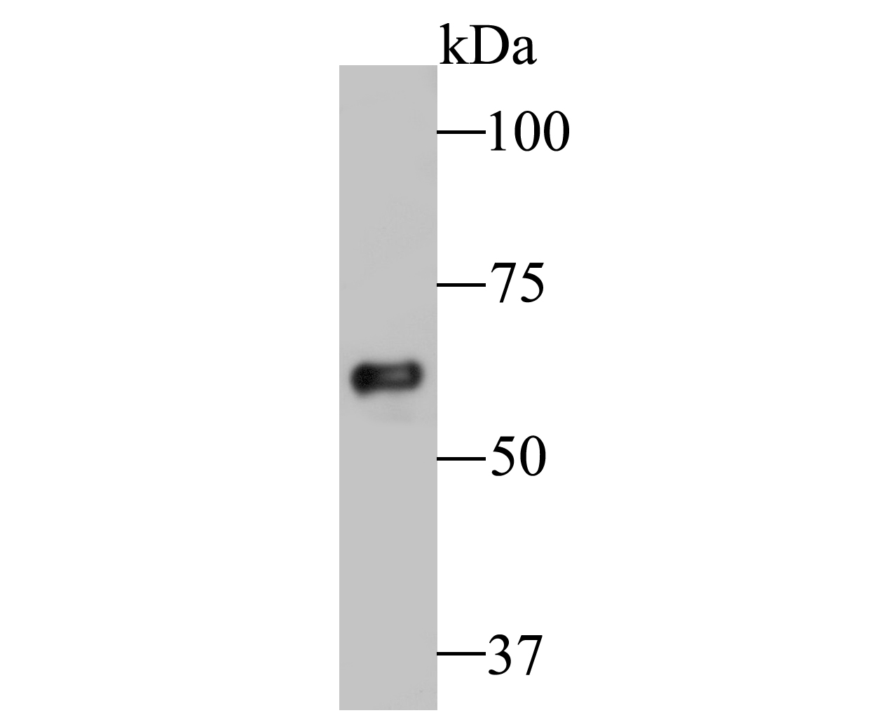 Western blot analysis of TCP1 alpha/CCTA on Daudi cell lysate. Proteins were transferred to a PVDF membrane and blocked with 5% BSA in PBS for 1 hour at room temperature. The primary antibody (ET7109-79, 1/500) was used in 5% BSA at room temperature for 2 hours. Goat Anti-Rabbit IgG - HRP Secondary Antibody (HA1001) at 1:5,000 dilution was used for 1 hour at room temperature.