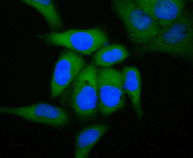 ICC staining of GCDFP 15 in Hela cells (green). Formalin fixed cells were permeabilized with 0.1% Triton X-100 in TBS for 10 minutes at room temperature and blocked with 1% Blocker BSA for 15 minutes at room temperature. Cells were probed with the primary antibody (ET7109-80, 1/50) for 1 hour at room temperature, washed with PBS. Alexa Fluor®488 Goat anti-Rabbit IgG was used as the secondary antibody at 1/100 dilution. The nuclear counter stain is DAPI (blue).