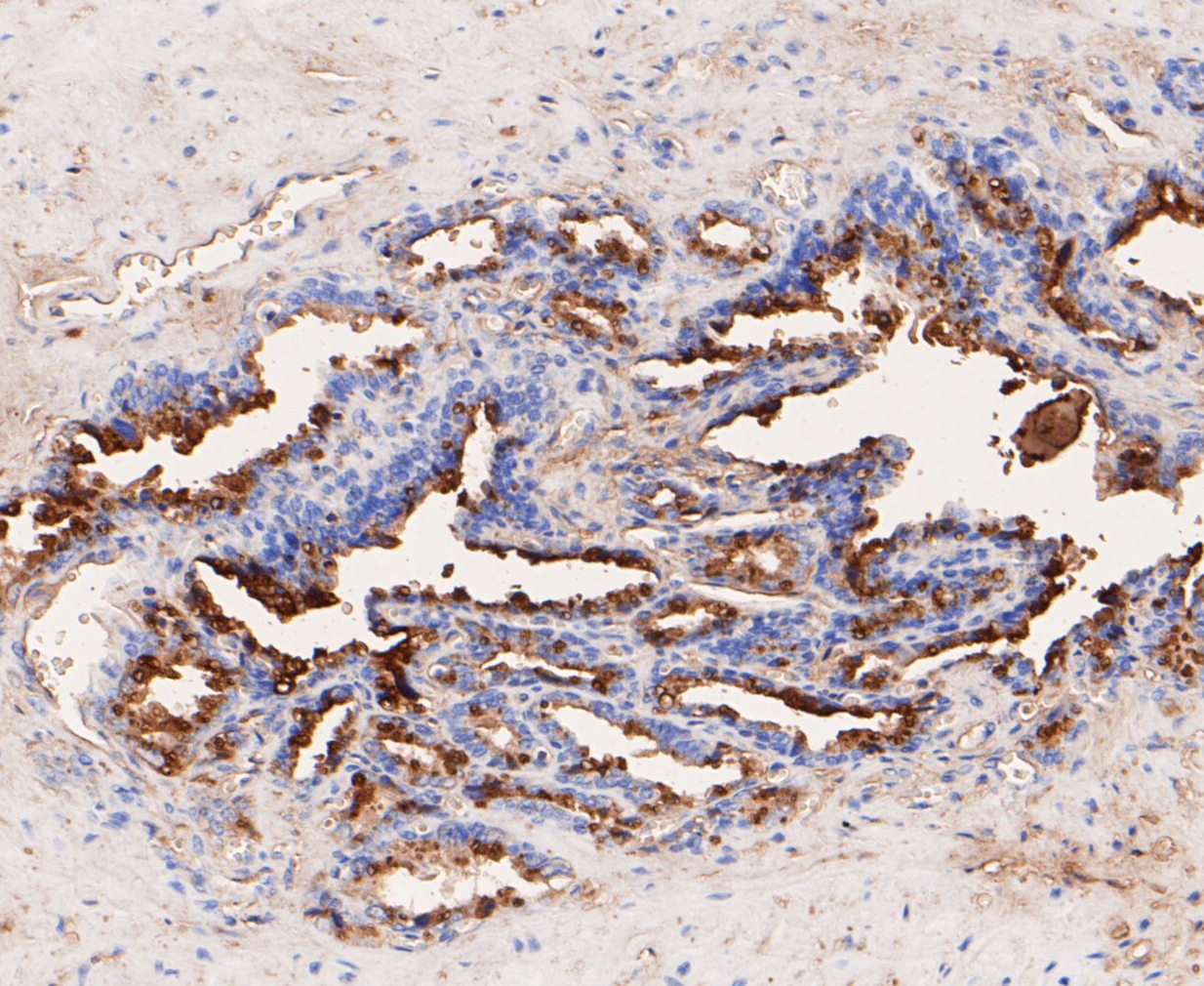 Immunohistochemical analysis of paraffin-embedded human seminal vesicle tissue using anti-GCDFP 15 antibody. The section was pre-treated using heat mediated antigen retrieval with Tris-EDTA buffer (pH 8.0-8.4) for 20 minutes.The tissues were blocked in 5% BSA for 30 minutes at room temperature, washed with ddH2O and PBS, and then probed with the primary antibody (ET7109-80, 1/50) for 30 minutes at room temperature. The detection was performed using an HRP conjugated compact polymer system. DAB was used as the chromogen. Tissues were counterstained with hematoxylin and mounted with DPX.