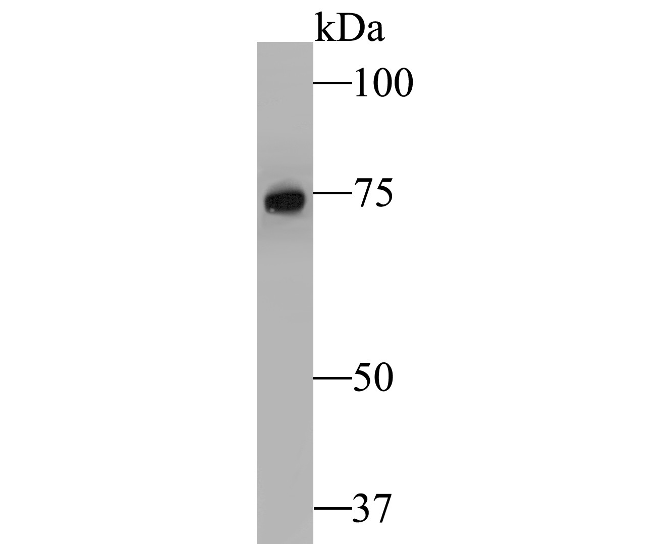 Western blot analysis of RSK1 p90 on Daudi cell lysate. Proteins were transferred to a PVDF membrane and blocked with 5% BSA in PBS for 1 hour at room temperature. The primary antibody (ET7109-83, 1/500) was used in 5% BSA at room temperature for 2 hours. Goat Anti-Rabbit IgG - HRP Secondary Antibody (HA1001) at 1:5,000 dilution was used for 1 hour at room temperature.