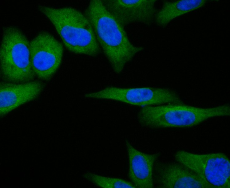 ICC staining of RSK1 p90 in Hela cells (green). Formalin fixed cells were permeabilized with 0.1% Triton X-100 in TBS for 10 minutes at room temperature and blocked with 1% Blocker BSA for 15 minutes at room temperature. Cells were probed with the primary antibody (ET7109-83, 1/50) for 1 hour at room temperature, washed with PBS. Alexa Fluor®488 Goat anti-Rabbit IgG was used as the secondary antibody at 1/100 dilution. The nuclear counter stain is DAPI (blue).