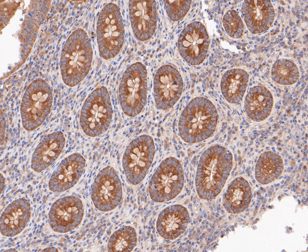 Immunohistochemical analysis of paraffin-embedded human appendix tissue using anti-RSK1 p90 antibody. The section was pre-treated using heat mediated antigen retrieval with sodium citrate buffer (pH 6.0) for 20 minutes. The tissues were blocked in 5% BSA for 30 minutes at room temperature, washed with ddH2O and PBS, and then probed with the primary antibody (ET7109-83, 1/200)  for 30 minutes at room temperature. The detection was performed using an HRP conjugated compact polymer system. DAB was used as the chromogen. Tissues were counterstained with hematoxylin and mounted with DPX.