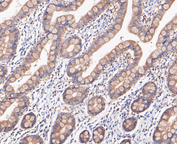 Immunohistochemical analysis of paraffin-embedded human small intestine tissue using anti-RSK1 p90 antibody. The section was pre-treated using heat mediated antigen retrieval with sodium citrate buffer (pH 6.0) for 20 minutes. The tissues were blocked in 5% BSA for 30 minutes at room temperature, washed with ddH2O and PBS, and then probed with the primary antibody (ET7109-83, 1/200)  for 30 minutes at room temperature. The detection was performed using an HRP conjugated compact polymer system. DAB was used as the chromogen. Tissues were counterstained with hematoxylin and mounted with DPX.