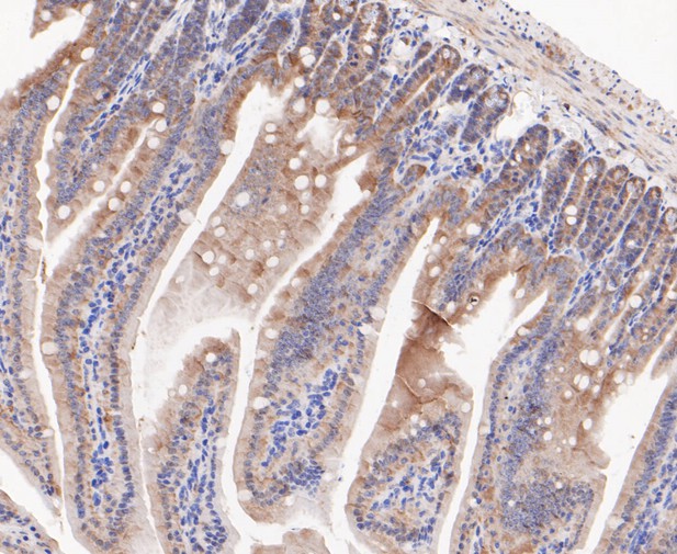 Immunohistochemical analysis of paraffin-embedded mouse colon tissue using anti-RSK1 p90 antibody. The section was pre-treated using heat mediated antigen retrieval with sodium citrate buffer (pH 6.0) for 20 minutes. The tissues were blocked in 5% BSA for 30 minutes at room temperature, washed with ddH2O and PBS, and then probed with the primary antibody (ET7109-83, 1/200)  for 30 minutes at room temperature. The detection was performed using an HRP conjugated compact polymer system. DAB was used as the chromogen. Tissues were counterstained with hematoxylin and mounted with DPX.