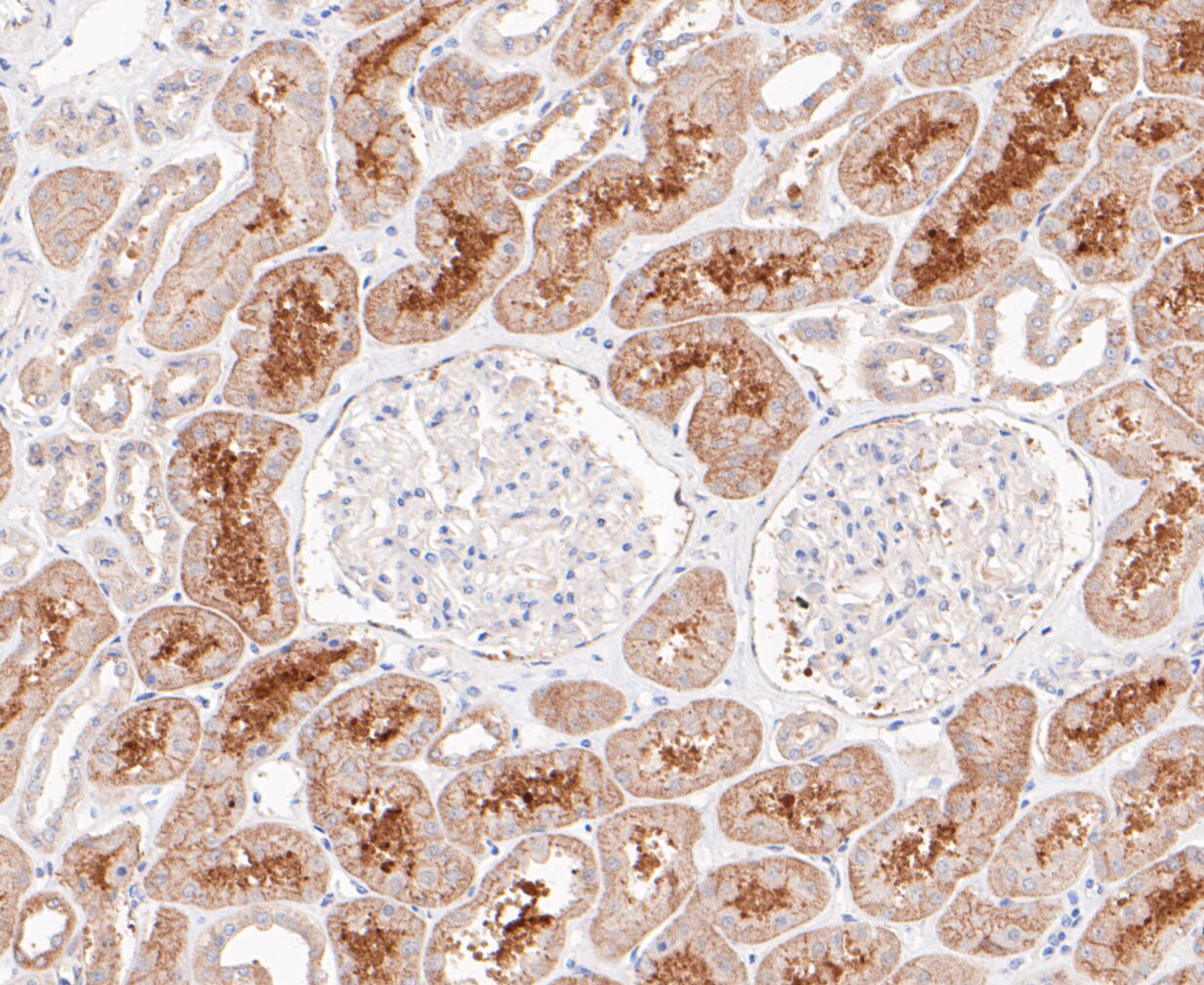 Immunohistochemical analysis of paraffin-embedded human kidney tissue using anti-CLSTN1 antibody. The section was pre-treated using heat mediated antigen retrieval with sodium citrate buffer (pH 6.0) for 20 minutes. The tissues were blocked in 5% BSA for 30 minutes at room temperature, washed with ddH2O and PBS, and then probed with the primary antibody (ET7109-84, 1/200)  for 30 minutes at room temperature. The detection was performed using an HRP conjugated compact polymer system. DAB was used as the chromogen. Tissues were counterstained with hematoxylin and mounted with DPX.