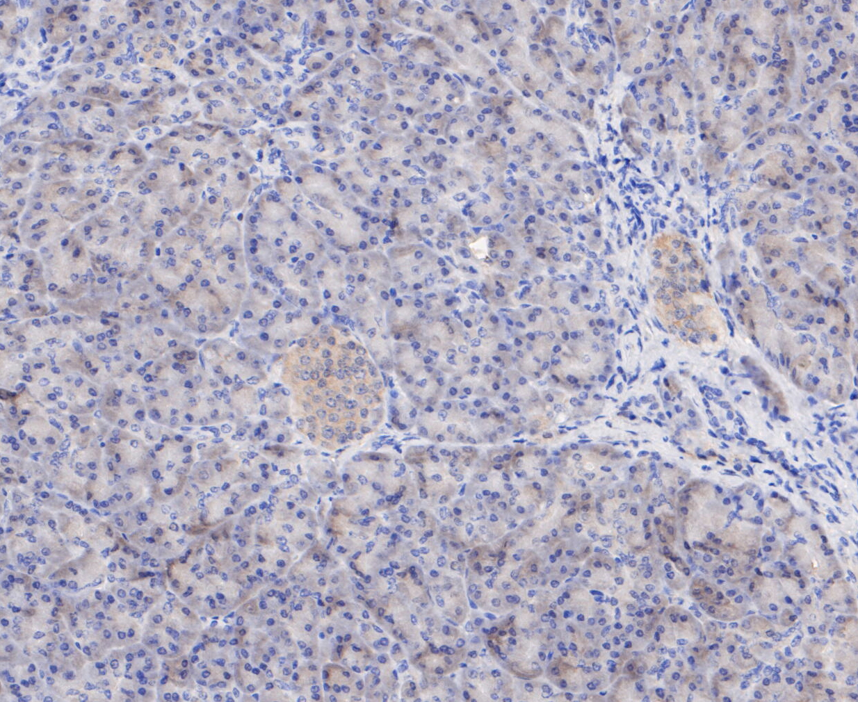 Immunohistochemical analysis of paraffin-embedded human pancreas tissue using anti-PSMD14 antibody. The section was pre-treated using heat mediated antigen retrieval with sodium citrate buffer (pH 6.0) for 20 minutes. The tissues were blocked in 5% BSA for 30 minutes at room temperature, washed with ddH2O and PBS, and then probed with the primary antibody (ET7109-85, 1/50)  for 30 minutes at room temperature. The detection was performed using an HRP conjugated compact polymer system. DAB was used as the chromogen. Tissues were counterstained with hematoxylin and mounted with DPX.