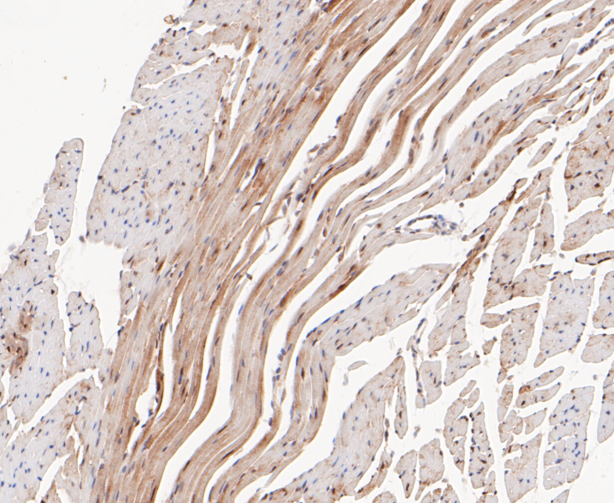 Immunohistochemical analysis of paraffin-embedded mouse heart tissue using anti-PSMD14 antibody. The section was pre-treated using heat mediated antigen retrieval with sodium citrate buffer (pH 6.0) for 20 minutes. The tissues were blocked in 5% BSA for 30 minutes at room temperature, washed with ddH2O and PBS, and then probed with the primary antibody (ET7109-85, 1/50)  for 30 minutes at room temperature. The detection was performed using an HRP conjugated compact polymer system. DAB was used as the chromogen. Tissues were counterstained with hematoxylin and mounted with DPX.