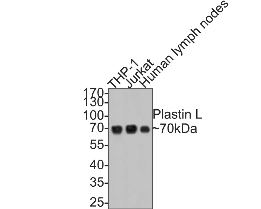 Western blot analysis of Plastin L on different lysates. Proteins were transferred to a PVDF membrane and blocked with 5% BSA in PBS for 1 hour at room temperature. The primary antibody (ET7109-87, 1/500) was used in 5% BSA at room temperature for 2 hours. Goat Anti-Rabbit IgG - HRP Secondary Antibody (HA1001) at 1:5,000 dilution was used for 1 hour at room temperature.<br />
Positive control: <br />
Lane 1: THP-1 cell lysate<br />
Lane 2: Jurkat cell lysate<br />
Lane 3: Human Lymph node lysate