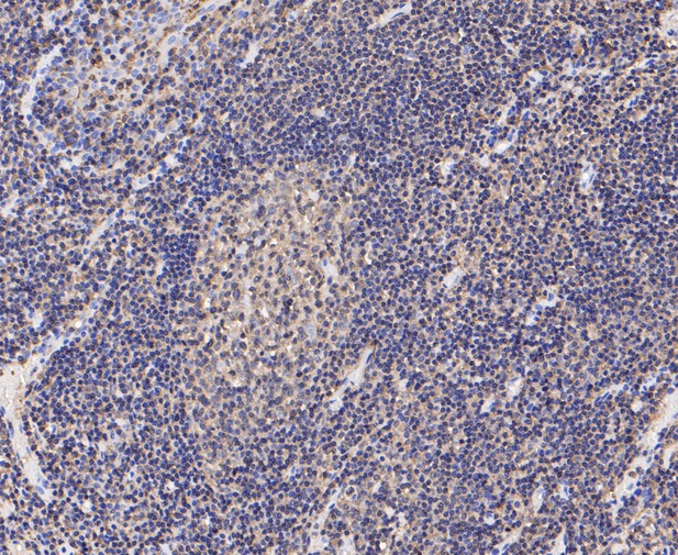 Immunohistochemical analysis of paraffin-embedded human tonsil tissue using anti-Plastin L antibody. The section was pre-treated using heat mediated antigen retrieval with Tris-EDTA buffer (pH 8.0-8.4) for 20 minutes.The tissues were blocked in 5% BSA for 30 minutes at room temperature, washed with ddH2O and PBS, and then probed with the primary antibody (ET7109-87, 1/200) for 30 minutes at room temperature. The detection was performed using an HRP conjugated compact polymer system. DAB was used as the chromogen. Tissues were counterstained with hematoxylin and mounted with DPX.