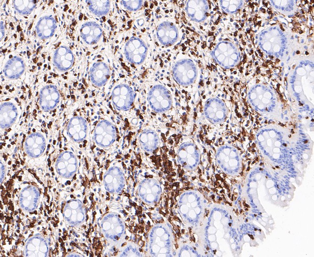 Immunohistochemical analysis of paraffin-embedded human colon tissue using anti-Plastin L antibody. The section was pre-treated using heat mediated antigen retrieval with Tris-EDTA buffer (pH 8.0-8.4) for 20 minutes.The tissues were blocked in 5% BSA for 30 minutes at room temperature, washed with ddH2O and PBS, and then probed with the primary antibody (ET7109-87, 1/200) for 30 minutes at room temperature. The detection was performed using an HRP conjugated compact polymer system. DAB was used as the chromogen. Tissues were counterstained with hematoxylin and mounted with DPX.