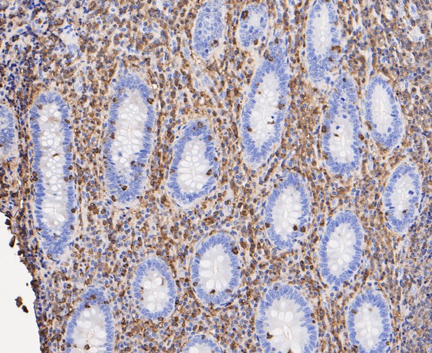 Immunohistochemical analysis of paraffin-embedded human appendix tissue using anti-Plastin L antibody. The section was pre-treated using heat mediated antigen retrieval with Tris-EDTA buffer (pH 8.0-8.4) for 20 minutes.The tissues were blocked in 5% BSA for 30 minutes at room temperature, washed with ddH2O and PBS, and then probed with the primary antibody (ET7109-87, 1/200) for 30 minutes at room temperature. The detection was performed using an HRP conjugated compact polymer system. DAB was used as the chromogen. Tissues were counterstained with hematoxylin and mounted with DPX.