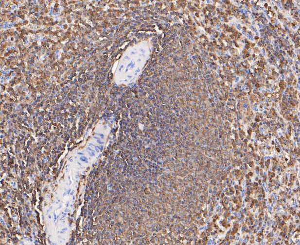 Immunohistochemical analysis of paraffin-embedded human spleen tissue using anti-Plastin L antibody. The section was pre-treated using heat mediated antigen retrieval with Tris-EDTA buffer (pH 8.0-8.4) for 20 minutes.The tissues were blocked in 5% BSA for 30 minutes at room temperature, washed with ddH2O and PBS, and then probed with the primary antibody (ET7109-87, 1/50) for 30 minutes at room temperature. The detection was performed using an HRP conjugated compact polymer system. DAB was used as the chromogen. Tissues were counterstained with hematoxylin and mounted with DPX.