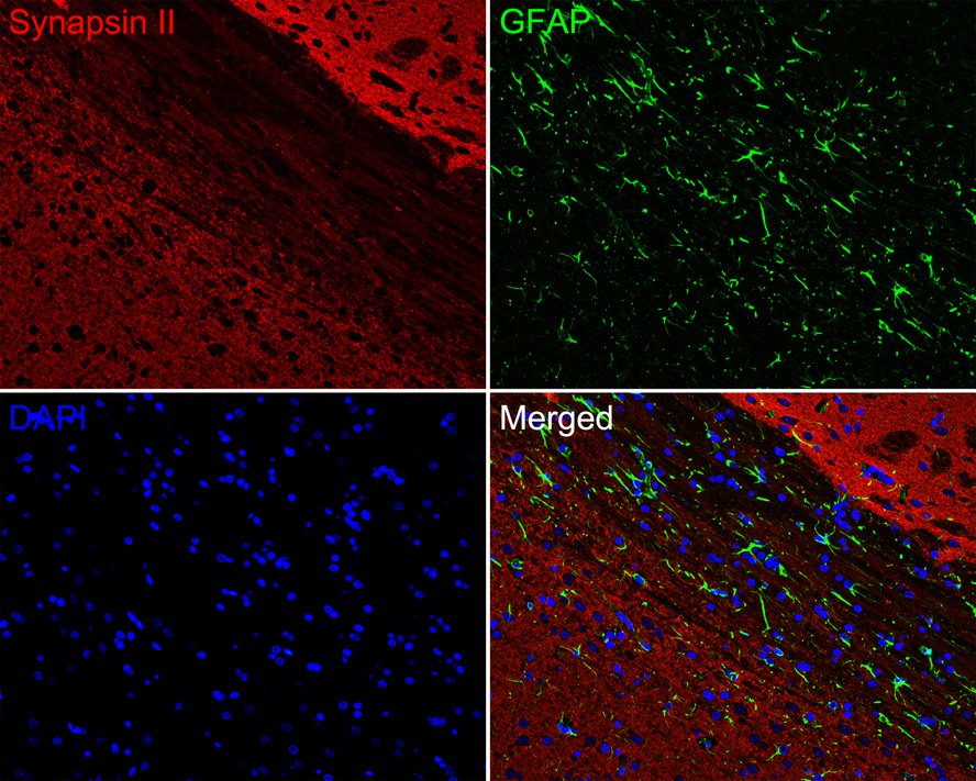 Immunofluorescence analysis of paraffin-embedded rat brain tissue labeling Synapsin II (ET7109-88) and GFAP (EM140707).<br />
<br />
The section was pre-treated using heat mediated antigen retrieval with Tris-EDTA buffer (pH 9.0) for 20 minutes. The tissues were blocked in 10% negative goat serum for 1 hour at room temperature, washed with PBS. And then probed with the primary antibodies Synapsin II (ET7109-88, red) at 1/200 dilution and GFAP (EM140707, green) at 1/400 dilution overnight at 4 ℃, washed with PBS.<br />
<br />
iFluor™ 594 conjugate-Goat anti-Rabbit IgG (HA1122) and iFluor™ 488 conjugate-Goat anti-Mouse IgG (HA1125) were used as the secondary antibodies at 1/1,000 dilution. DAPI was used as nuclear counterstain.
