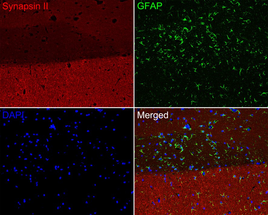 Immunofluorescence analysis of paraffin-embedded mouse brain tissue labeling Synapsin II (ET7109-88) and GFAP (EM140707).<br />
<br />
The section was pre-treated using heat mediated antigen retrieval with Tris-EDTA buffer (pH 9.0) for 20 minutes. The tissues were blocked in 10% negative goat serum for 1 hour at room temperature, washed with PBS. And then probed with the primary antibodies Synapsin II (ET7109-88, red) at 1/200 dilution and GFAP (EM140707, green) at 1/400 dilution overnight at 4 ℃, washed with PBS.<br />
<br />
iFluor™ 594 conjugate-Goat anti-Rabbit IgG (HA1122) and iFluor™ 488 conjugate-Goat anti-Mouse IgG (HA1125) were used as the secondary antibodies at 1/1,000 dilution. DAPI was used as nuclear counterstain.