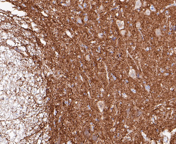 Immunohistochemical analysis of paraffin-embedded rat bone marrow tissue using anti-Synapsin II antibody. The section was pre-treated using heat mediated antigen retrieval with Tris-EDTA buffer (pH 8.0-8.4) for 20 minutes.The tissues were blocked in 5% BSA for 30 minutes at room temperature, washed with ddH2O and PBS, and then probed with the primary antibody (ET7109-88, 1/200) for 30 minutes at room temperature. The detection was performed using an HRP conjugated compact polymer system. DAB was used as the chromogen. Tissues were counterstained with hematoxylin and mounted with DPX.