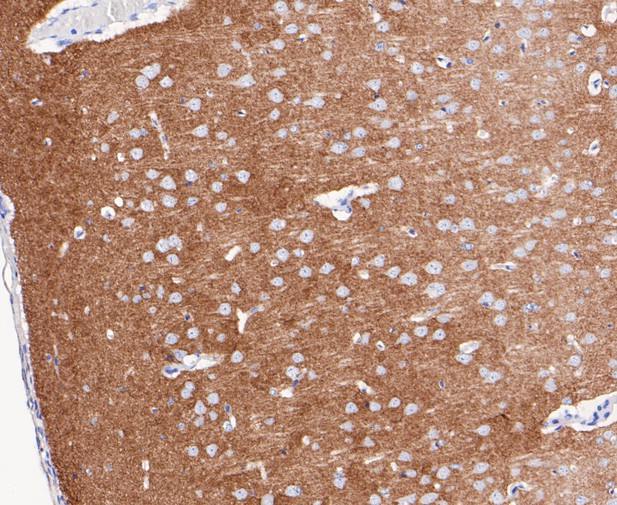 Immunohistochemical analysis of paraffin-embedded rat brain tissue using anti-Synapsin II antibody. The section was pre-treated using heat mediated antigen retrieval with Tris-EDTA buffer (pH 8.0-8.4) for 20 minutes.The tissues were blocked in 5% BSA for 30 minutes at room temperature, washed with ddH2O and PBS, and then probed with the primary antibody (ET7109-88, 1/200) for 30 minutes at room temperature. The detection was performed using an HRP conjugated compact polymer system. DAB was used as the chromogen. Tissues were counterstained with hematoxylin and mounted with DPX.