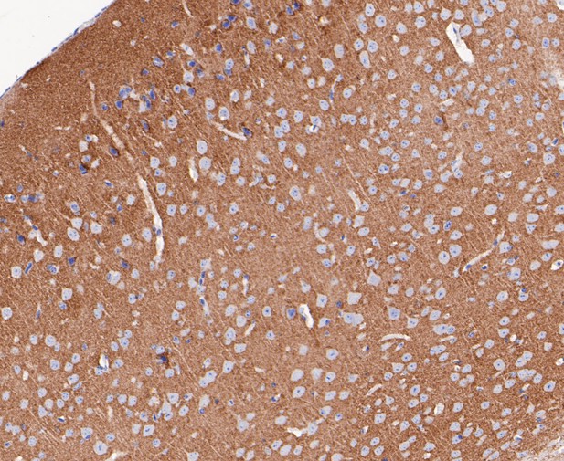 Immunohistochemical analysis of paraffin-embedded mouse brain tissue using anti-Synapsin II antibody. The section was pre-treated using heat mediated antigen retrieval with Tris-EDTA buffer (pH 8.0-8.4) for 20 minutes.The tissues were blocked in 5% BSA for 30 minutes at room temperature, washed with ddH2O and PBS, and then probed with the primary antibody (ET7109-88, 1/50) for 30 minutes at room temperature. The detection was performed using an HRP conjugated compact polymer system. DAB was used as the chromogen. Tissues were counterstained with hematoxylin and mounted with DPX.