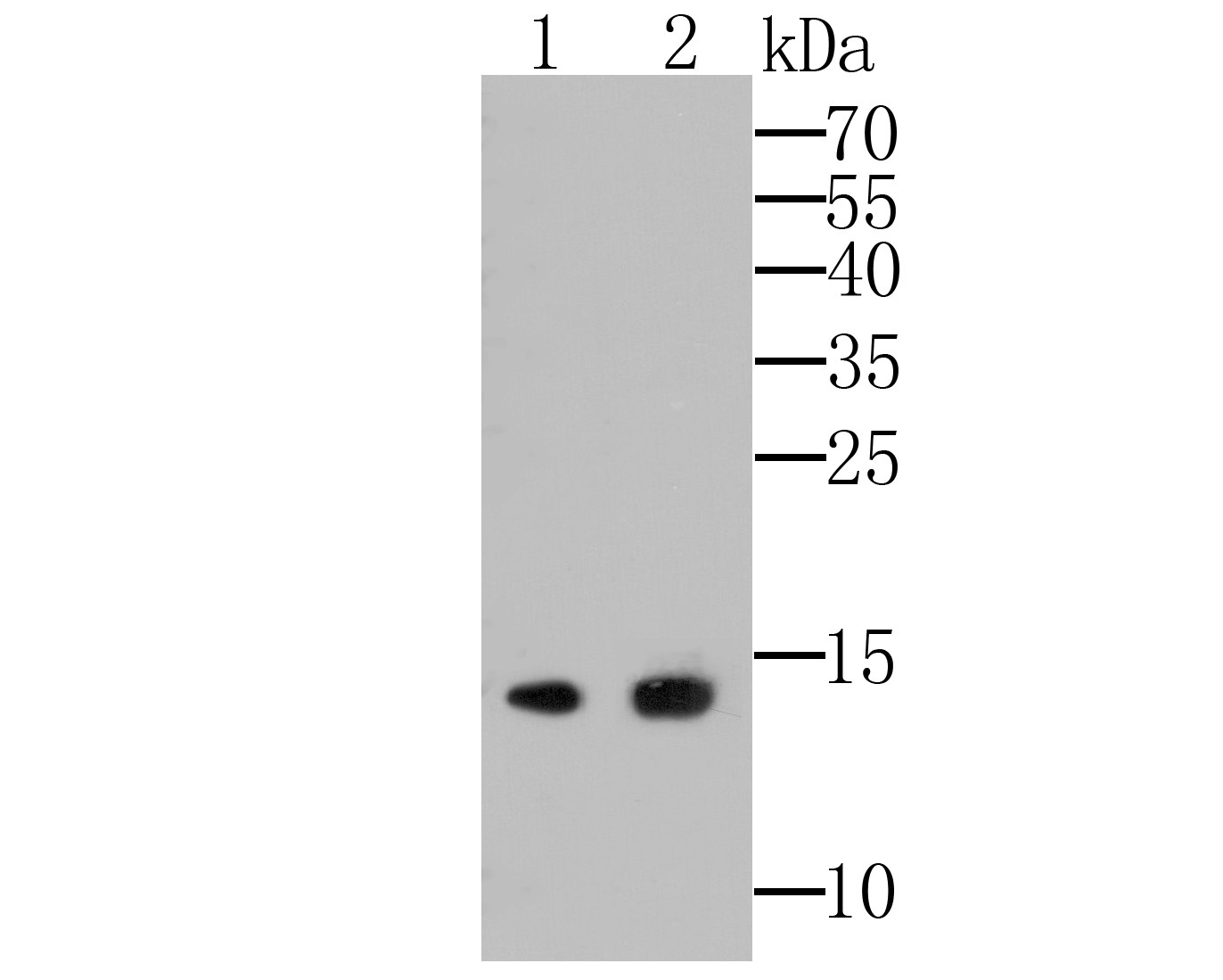 Western blot analysis of APRIL/TNFSF13 on different lysates. Proteins were transferred to a PVDF membrane and blocked with 5% BSA in PBS for 1 hour at room temperature. The primary antibody (ET7109-89, 1/500) was used in 5% BSA at room temperature for 2 hours. Goat Anti-Rabbit IgG - HRP Secondary Antibody (HA1001) at 1:5,000 dilution was used for 1 hour at room temperature.<br />
<br />
Lane 1: Hela cell lysate<br />
Lane 2: A549 cell lysate<br />
<br />
Predicted band size: 27 kDa<br />
Observed band size: 14 kDa