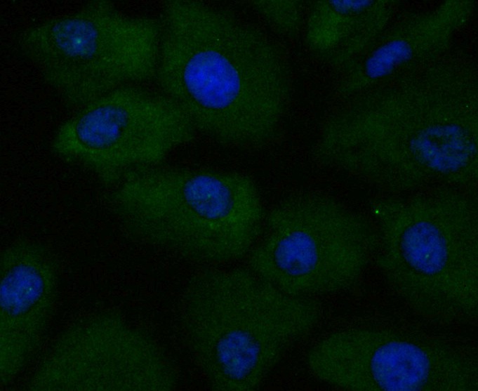 ICC staining of APRIL/TNFSF13 in A549 cells (green). Formalin fixed cells were permeabilized with 0.1% Triton X-100 in TBS for 10 minutes at room temperature and blocked with 1% Blocker BSA for 15 minutes at room temperature. Cells were probed with the primary antibody (ET7109-89, 1/50) for 1 hour at room temperature, washed with PBS. Alexa Fluor®488 Goat anti-Rabbit IgG was used as the secondary antibody at 1/100 dilution. The nuclear counter stain is DAPI (blue).