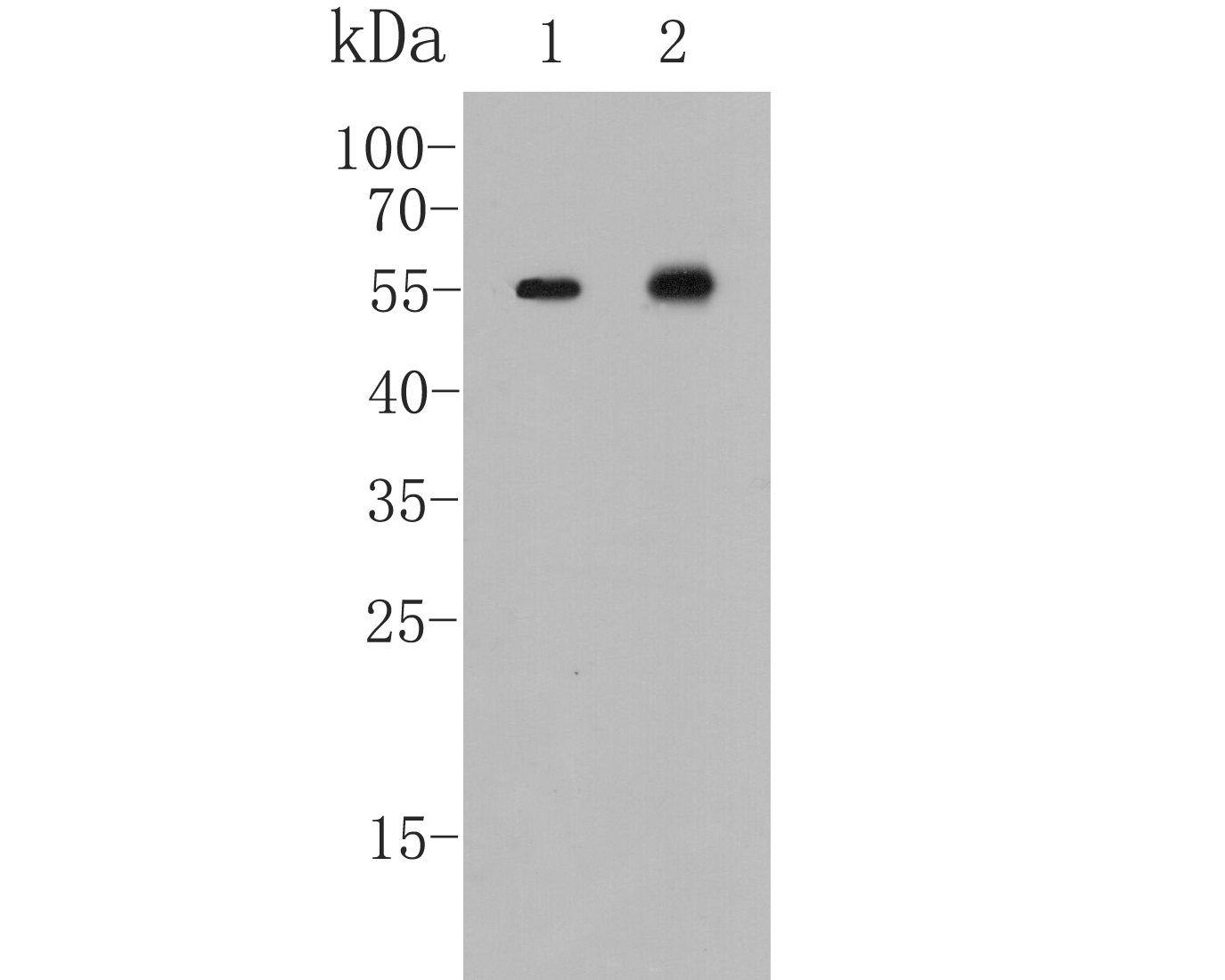 Western blot analysis of ICAD on different lysates. Proteins were transferred to a PVDF membrane and blocked with 5% BSA in PBS for 1 hour at room temperature. The primary antibody (ET7109-91, 1/500) was used in 5% BSA at room temperature for 2 hours. Goat Anti-Rabbit IgG - HRP Secondary Antibody (HA1001) at 1:5,000 dilution was used for 1 hour at room temperature.<br />
Positive control: <br />
Lane 1: Jurkat cell lysate <br />
Lane 2: Human stomach tissue lysate<br />
<br />
Predicted band size: 37 kDa<br />
Observed band size: 55 kDa