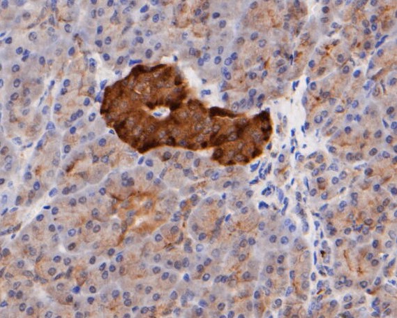 Immunohistochemical analysis of paraffin-embedded human pancreas intestine tissue using anti-ICAD antibody. The section was pre-treated using heat mediated antigen retrieval with sodium citrate buffer (pH 6.0) for 20 minutes. The tissues were blocked in 5% BSA for 30 minutes at room temperature, washed with ddH2O and PBS, and then probed with the primary antibody (ET7109-91, 1/400)  for 30 minutes at room temperature. The detection was performed using an HRP conjugated compact polymer system. DAB was used as the chromogen. Tissues were counterstained with hematoxylin and mounted with DPX.