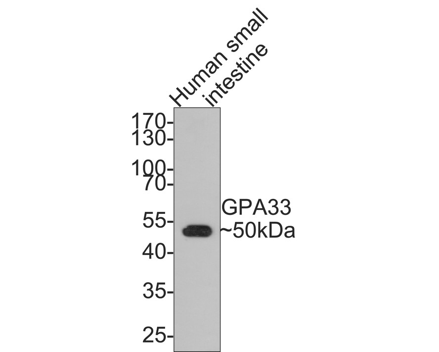 Western blot analysis of GPA33 on human small intestine tissue lysates with Rabbit anti-GPA33 antibody (ET7109-93) at 1/500 dilution.<br />
<br />
Lysates/proteins at 20 µg/Lane.<br />
<br />
Predicted band size: 36 kDa<br />
Observed band size: 50 kDa<br />
<br />
Exposure time: 2 minutes;<br />
<br />
10% SDS-PAGE gel.<br />
<br />
Proteins were transferred to a PVDF membrane and blocked with 5% NFDM/TBST for 1 hour at room temperature. The primary antibody (ET7109-93) at 1/500 dilution was used in 5% NFDM/TBST at room temperature for 2 hours. Goat Anti-Rabbit IgG - HRP Secondary Antibody (HA1001) at 1:300,000 dilution was used for 1 hour at room temperature.