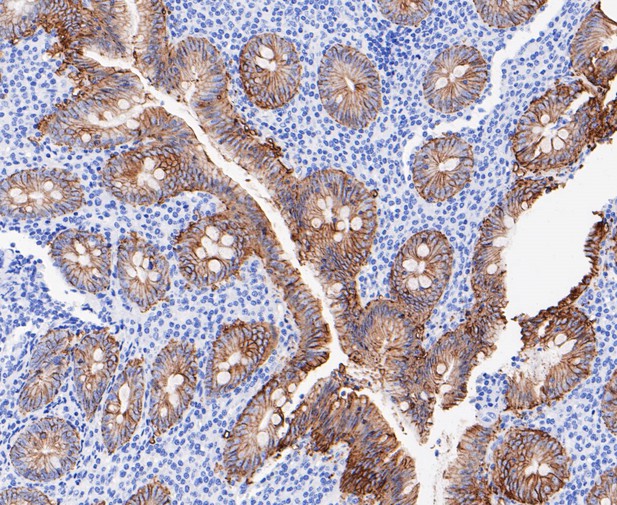 Immunohistochemical analysis of paraffin-embedded human appendix tissue using anti-GPA33 antibody. The section was pre-treated using heat mediated antigen retrieval with Tris-EDTA buffer (pH 8.0-8.4) for 20 minutes.The tissues were blocked in 5% BSA for 30 minutes at room temperature, washed with ddH2O and PBS, and then probed with the primary antibody (ET7109-93, 1/50) for 30 minutes at room temperature. The detection was performed using an HRP conjugated compact polymer system. DAB was used as the chromogen. Tissues were counterstained with hematoxylin and mounted with DPX.