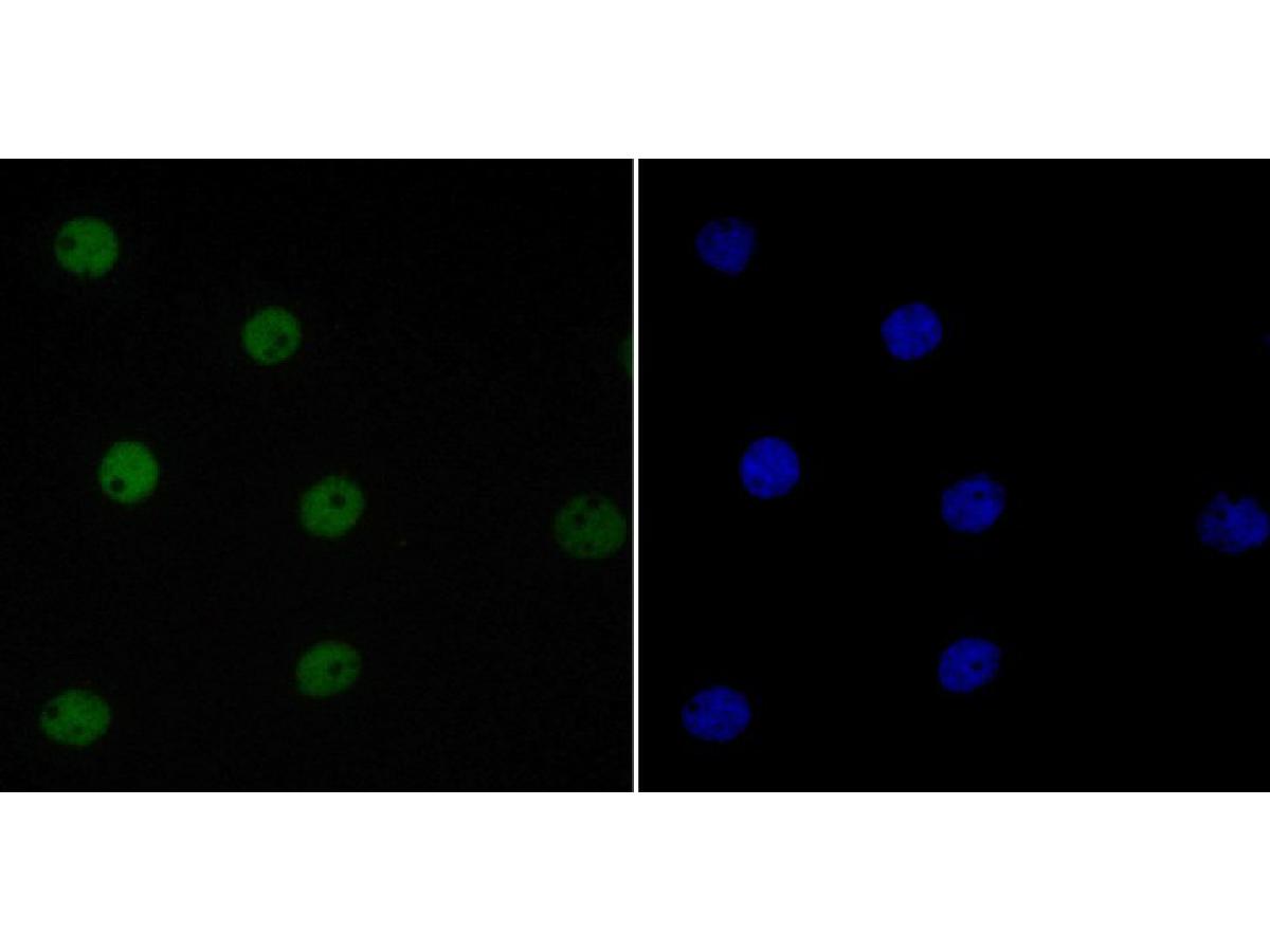 ICC staining of EWSR1/EWS in A431 cells (green). Formalin fixed cells were permeabilized with 0.1% Triton X-100 in TBS for 10 minutes at room temperature and blocked with 10% negative goat serum for 15 minutes at room temperature. Cells were probed with the primary antibody (ET7109-94, 1/50) for 1 hour at room temperature, washed with PBS. Alexa Fluor®488 conjugate-Goat anti-Rabbit IgG was used as the secondary antibody at 1/1,000 dilution. The nuclear counter stain is DAPI (blue).