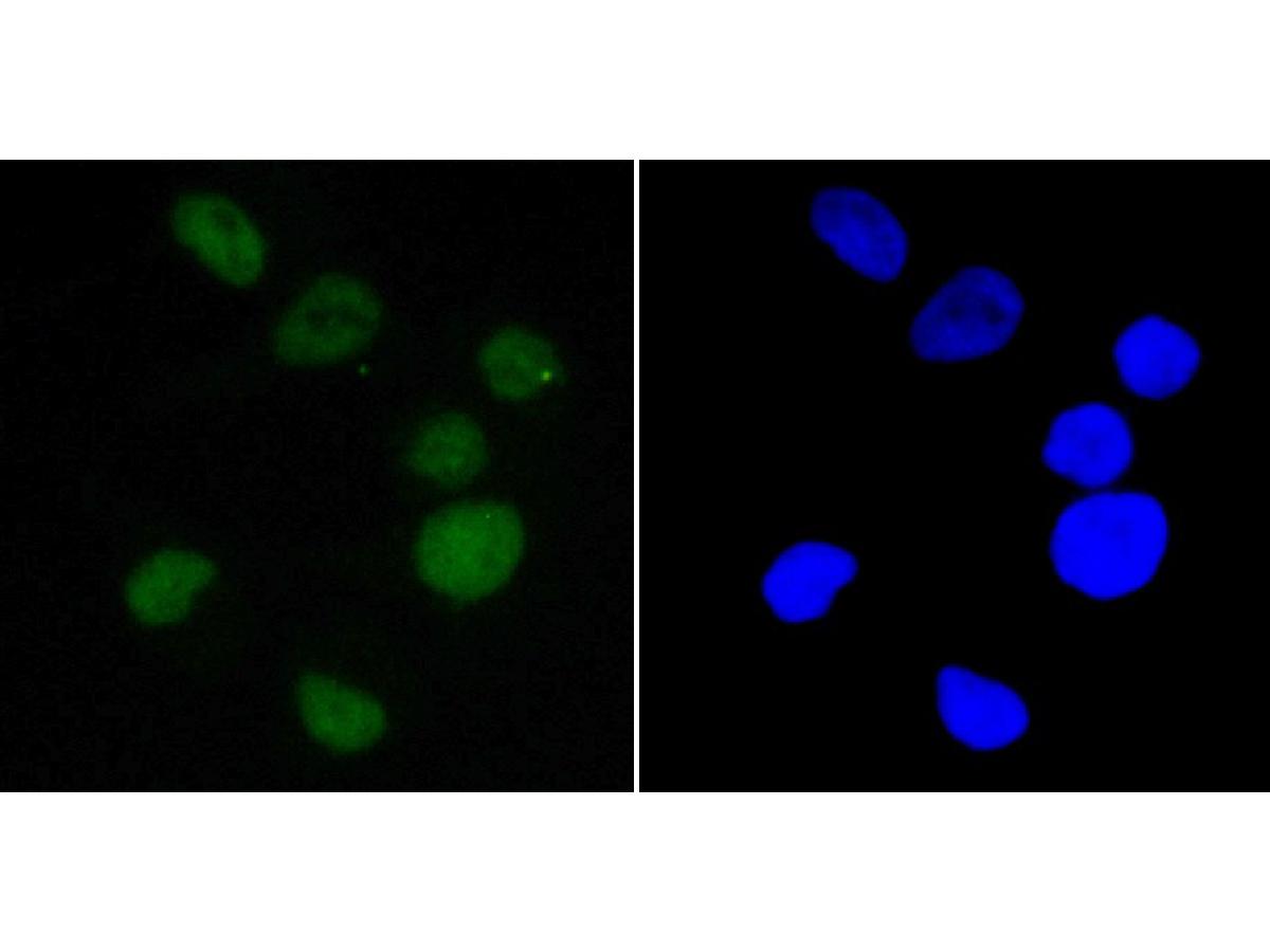 ICC staining of EWSR1/EWS in SK-Br-3 cells (green). Formalin fixed cells were permeabilized with 0.1% Triton X-100 in TBS for 10 minutes at room temperature and blocked with 10% negative goat serum for 15 minutes at room temperature. Cells were probed with the primary antibody (ET7109-94, 1/50) for 1 hour at room temperature, washed with PBS. Alexa Fluor®488 conjugate-Goat anti-Rabbit IgG was used as the secondary antibody at 1/1,000 dilution. The nuclear counter stain is DAPI (blue).