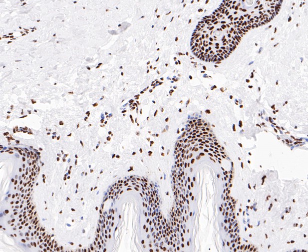 Immunohistochemical analysis of paraffin-embedded human skin tissue using anti-EWSR1/EWS antibody. The section was pre-treated using heat mediated antigen retrieval with sodium citrate buffer (pH 6.0) for 20 minutes. The tissues were blocked in 5% BSA for 30 minutes at room temperature, washed with ddH2O and PBS, and then probed with the primary antibody (ET7109-94, 1/50)  for 30 minutes at room temperature. The detection was performed using an HRP conjugated compact polymer system. DAB was used as the chromogen. Tissues were counterstained with hematoxylin and mounted with DPX.