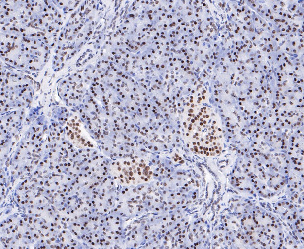 Immunohistochemical analysis of paraffin-embedded human pancreas tissue using anti-EWSR1/EWS antibody. The section was pre-treated using heat mediated antigen retrieval with sodium citrate buffer (pH 6.0) for 20 minutes. The tissues were blocked in 5% BSA for 30 minutes at room temperature, washed with ddH2O and PBS, and then probed with the primary antibody (ET7109-94, 1/50)  for 30 minutes at room temperature. The detection was performed using an HRP conjugated compact polymer system. DAB was used as the chromogen. Tissues were counterstained with hematoxylin and mounted with DPX.
