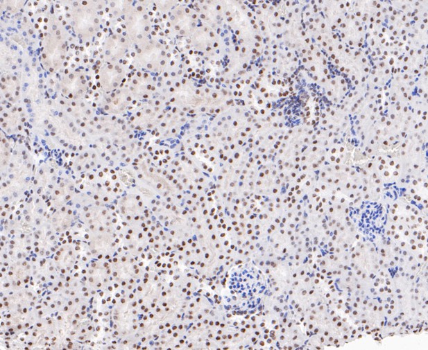Immunohistochemical analysis of paraffin-embedded mouse kidney tissue using anti-EWSR1/EWS antibody. The section was pre-treated using heat mediated antigen retrieval with sodium citrate buffer (pH 6.0) for 20 minutes. The tissues were blocked in 5% BSA for 30 minutes at room temperature, washed with ddH2O and PBS, and then probed with the primary antibody (ET7109-94, 1/50)  for 30 minutes at room temperature. The detection was performed using an HRP conjugated compact polymer system. DAB was used as the chromogen. Tissues were counterstained with hematoxylin and mounted with DPX.
