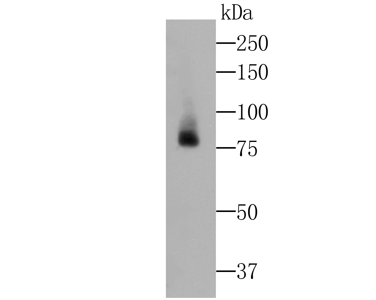 Western blot analysis of Lactoferrin on human kidney tissue lysate. Proteins were transferred to a PVDF membrane and blocked with 5% BSA in PBS for 1 hour at room temperature. The primary antibody was used at a 1:500 dilution in 5% BSA at room temperature for 2 hours. Goat Anti-Rabbit IgG - HRP Secondary Antibody (HA1001) at 1:5,000 dilution was used for 1 hour at room temperature.