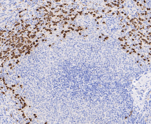 Immunohistochemical analysis of paraffin-embedded human spleen tissue using anti-Lactoferrin antibody. The section was pre-treated using heat mediated antigen retrieval with sodium citrate buffer (pH 6.0) for 20 minutes. The tissues were blocked in 5% BSA for 30 minutes at room temperature, washed with ddH2O and PBS, and then probed with the primary antibody (ET7109-95, 1/200)  for 30 minutes at room temperature. The detection was performed using an HRP conjugated compact polymer system. DAB was used as the chromogen. Tissues were counterstained with hematoxylin and mounted with DPX.