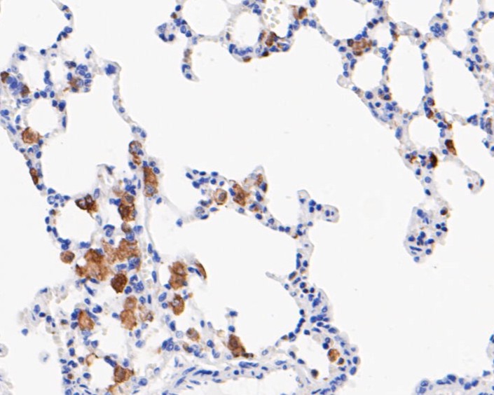 CD16 Recombinant Rabbit Monoclonal Antibody [JE49-79] - image 1