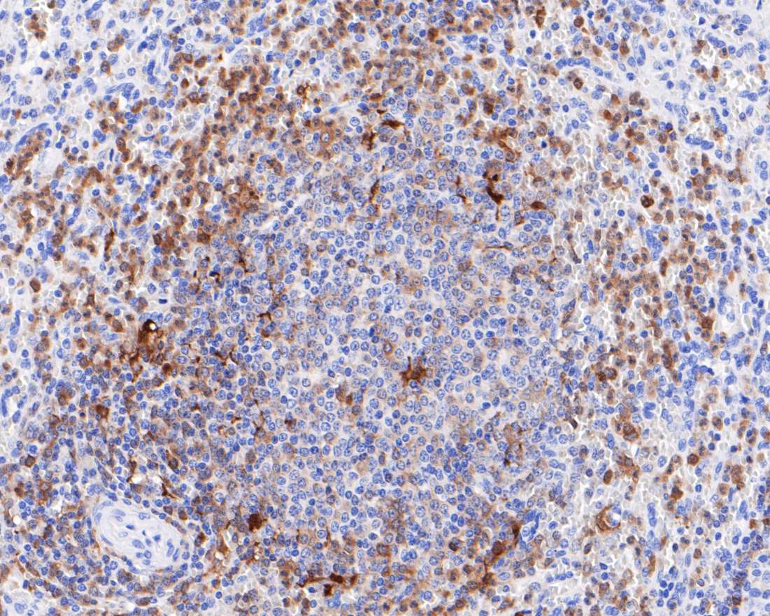 CD16 Recombinant Rabbit Monoclonal Antibody [JE49-79] - image 2