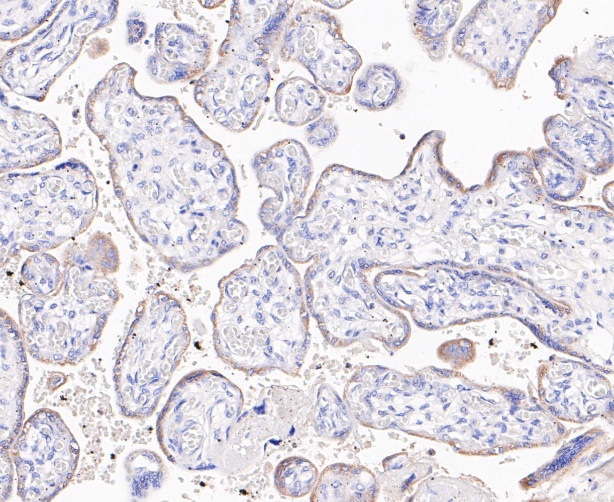 Immunohistochemical analysis of paraffin-embedded human placenta tissue using anti-ABAT/GABA-T antibody. The section was pre-treated using heat mediated antigen retrieval with Tris-EDTA buffer (pH 8.0-8.4) for 20 minutes.The tissues were blocked in 5% BSA for 30 minutes at room temperature, washed with ddH2O and PBS, and then probed with the primary antibody (ET7110-01, 1/200) for 1 hour at room temperature. The detection was performed using an HRP conjugated compact polymer system. DAB was used as the chromogen. Tissues were counterstained with hematoxylin and mounted with DPX.