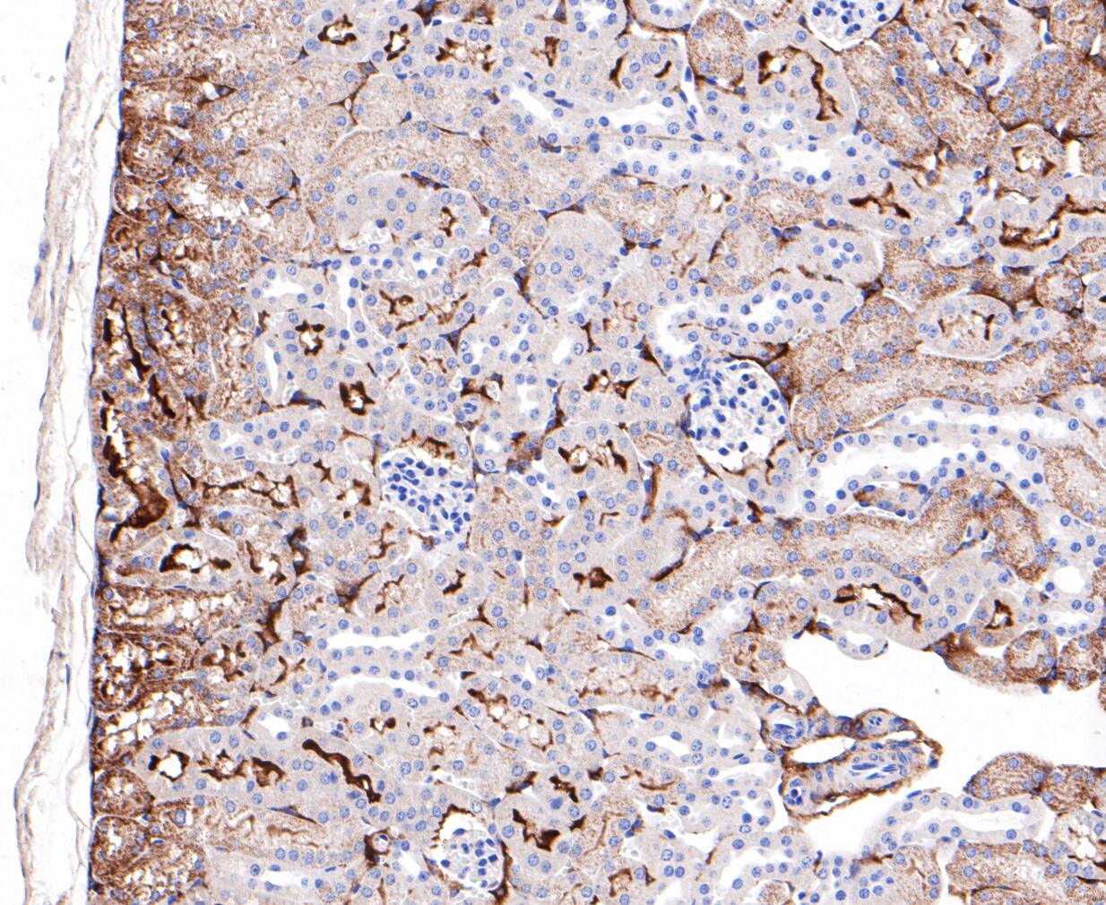Immunohistochemical analysis of paraffin-embedded mouse kidney tissue using anti-ABAT/GABA-T antibody. The section was pre-treated using heat mediated antigen retrieval with Tris-EDTA buffer (pH 8.0-8.4) for 20 minutes.The tissues were blocked in 5% BSA for 30 minutes at room temperature, washed with ddH2O and PBS, and then probed with the primary antibody (ET7110-01, 1/200) for 1 hour at room temperature. The detection was performed using an HRP conjugated compact polymer system. DAB was used as the chromogen. Tissues were counterstained with hematoxylin and mounted with DPX.