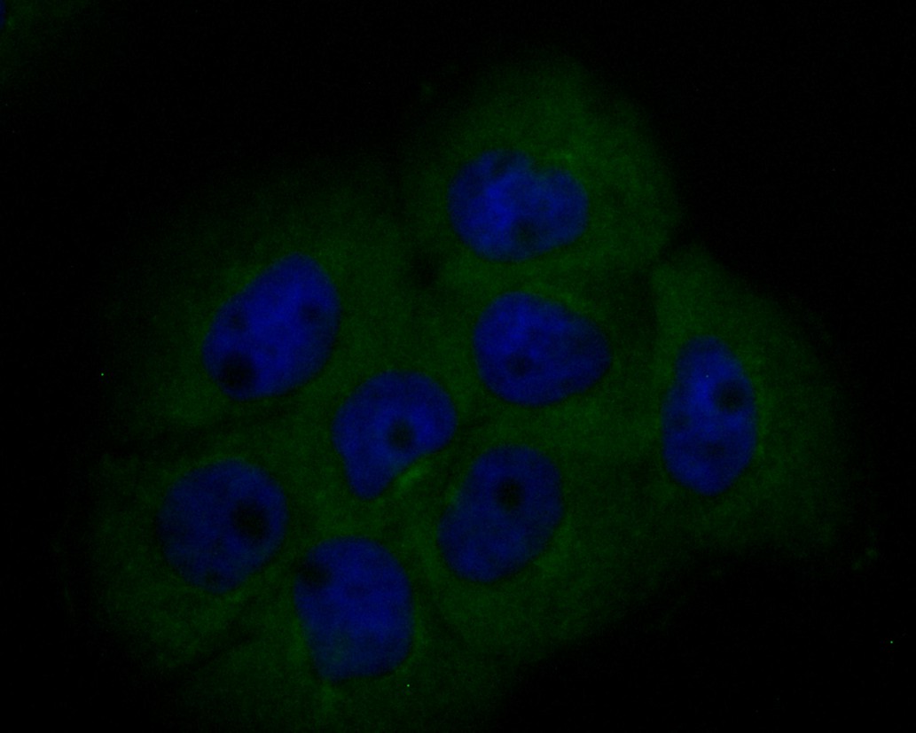 ICC staining of BCL2L12 in A431 cells (green). Formalin fixed cells were permeabilized with 0.1% Triton X-100 in TBS for 10 minutes at room temperature and blocked with 1% Blocker BSA for 15 minutes at room temperature. Cells were probed with the primary antibody (ET7110-02, 1/100) for 1 hour at room temperature, washed with PBS. Alexa Fluor®488 Goat anti-Rabbit IgG was used as the secondary antibody at 1/1,000 dilution. The nuclear counter stain is DAPI (blue).