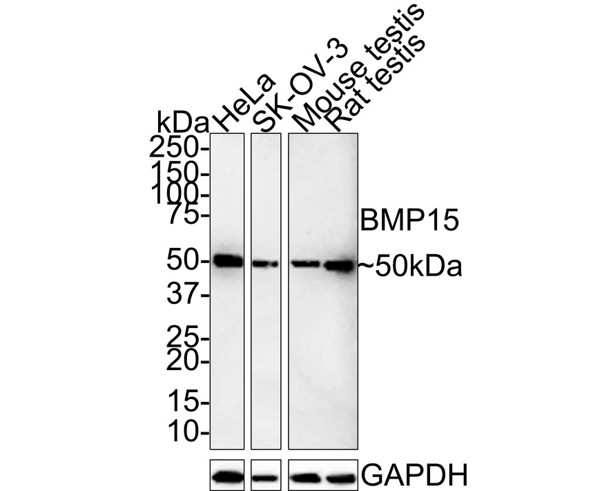 Western blot analysis of BMP15 on different lysates with Rabbit anti-BMP15 antibody (ET7110-03) at 1/1,000 dilution.<br />
<br />
Lane 1: HeLa cell lysate<br />
Lane 2: SK-OV-3 cell lysate<br />
Lane 3: Mouse testis tissue lysate<br />
Lane 4: Rat testis tissue lysate<br />
<br />
Lysates/proteins at 20 µg/Lane.<br />
<br />
Predicted band size: 45 kDa<br />
Observed band size: 50 kDa<br />
<br />
Exposure time: 5 minutes 30 seconds;<br />
<br />
4-20% SDS-PAGE gel.<br />
<br />
Proteins were transferred to a PVDF membrane and blocked with 5% NFDM/TBST for 1 hour at room temperature. The primary antibody (ET7110-03) at 1/1,000 dilution was used in 5% NFDM/TBST at room temperature for 2 hours. Goat Anti-Rabbit IgG - HRP Secondary Antibody (HA1001) at 1:100,000 dilution was used for 1 hour at room temperature.