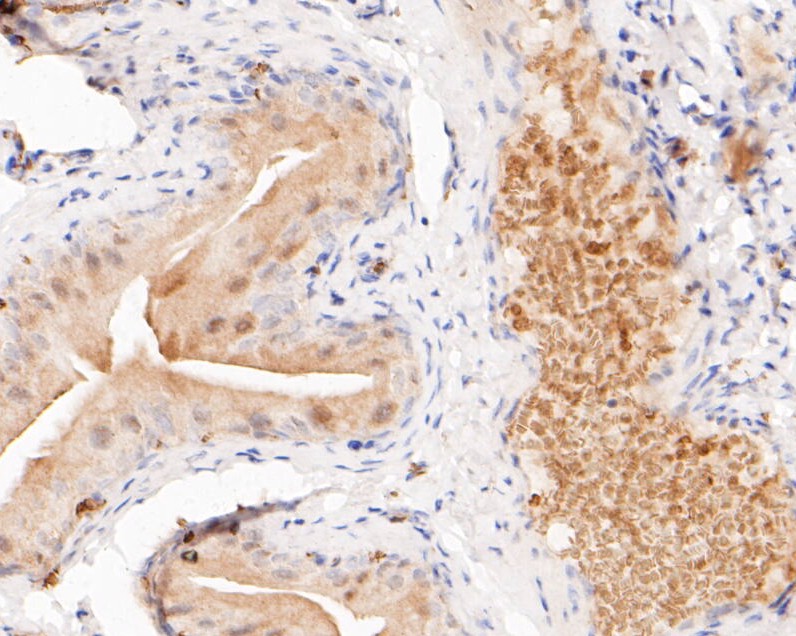 Immunohistochemical analysis of paraffin-embedded rat bladder tissue using anti-FBP1 antibody. The section was pre-treated using heat mediated antigen retrieval with sodium citrate buffer (pH 6.0) for 20 minutes. The tissues were blocked in 5% BSA for 30 minutes at room temperature, washed with ddH2O and PBS, and then probed with the primary antibody (ET7110-07, 1/200)  for 30 minutes at room temperature. The detection was performed using an HRP conjugated compact polymer system. DAB was used as the chromogen. Tissues were counterstained with hematoxylin and mounted with DPX.